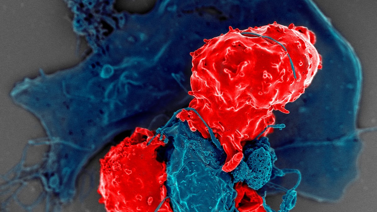 Scanning electron micrograph of a T-lymphocyte contacting a target cell — the immune synapse re-engineered by CAR-T cell therapy, a topic curated by Panacea Bio Chem and Bogdan Dicoias